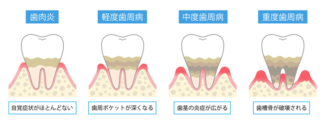 24385390_コピー