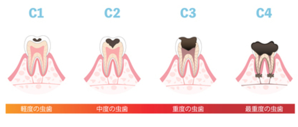 22845508_コピー_コピー_コピー