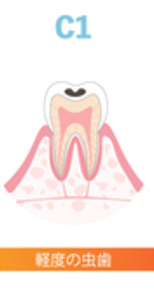 22845508_コピー_コピー_コピー