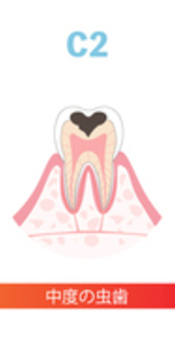 22845508_コピー_コピー_コピー