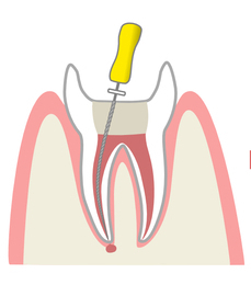 2382717_コピー_コピー