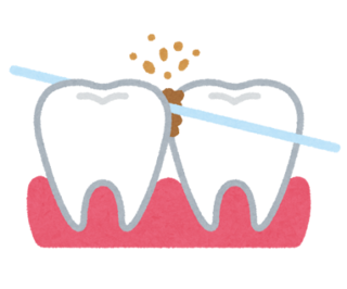 ha_floss_toru_コピー